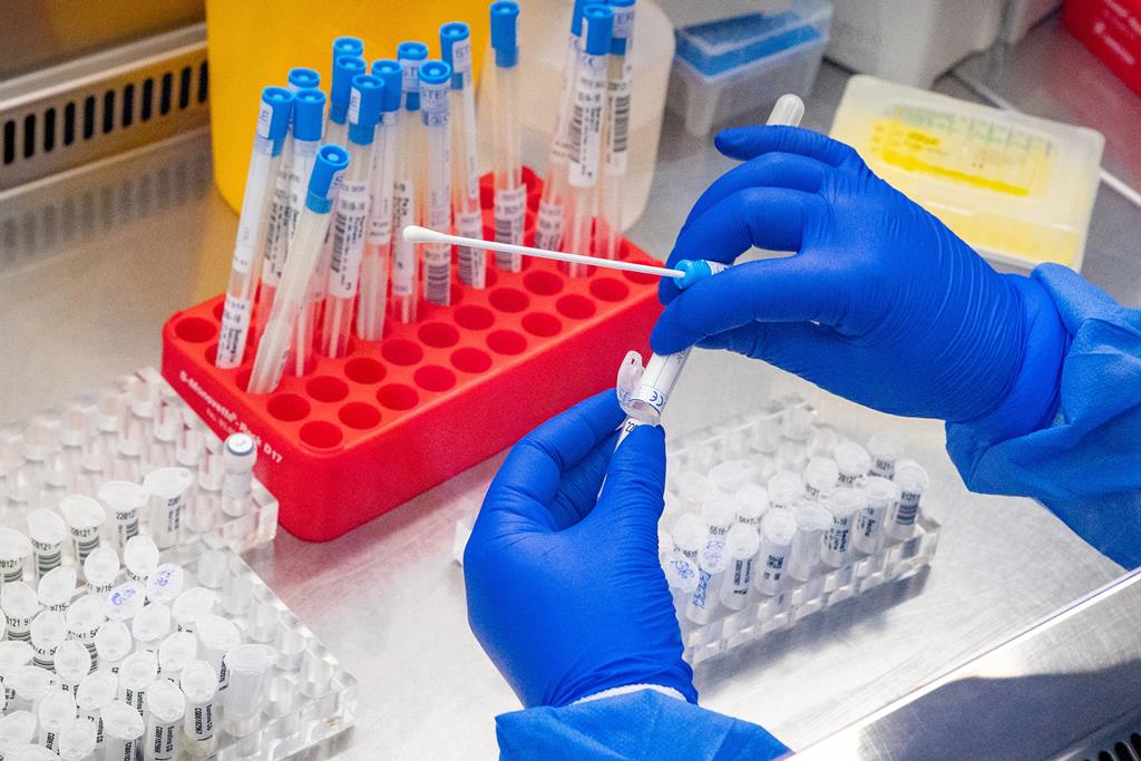 Amazonas ultrapassa 300 casos de varíola dos macacos