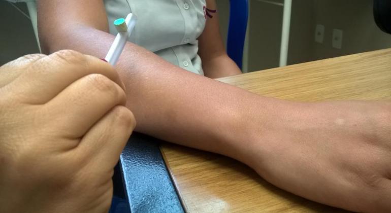 Alfredo da Matta anuncia mutirão de atendimento para identificação de hanseníase