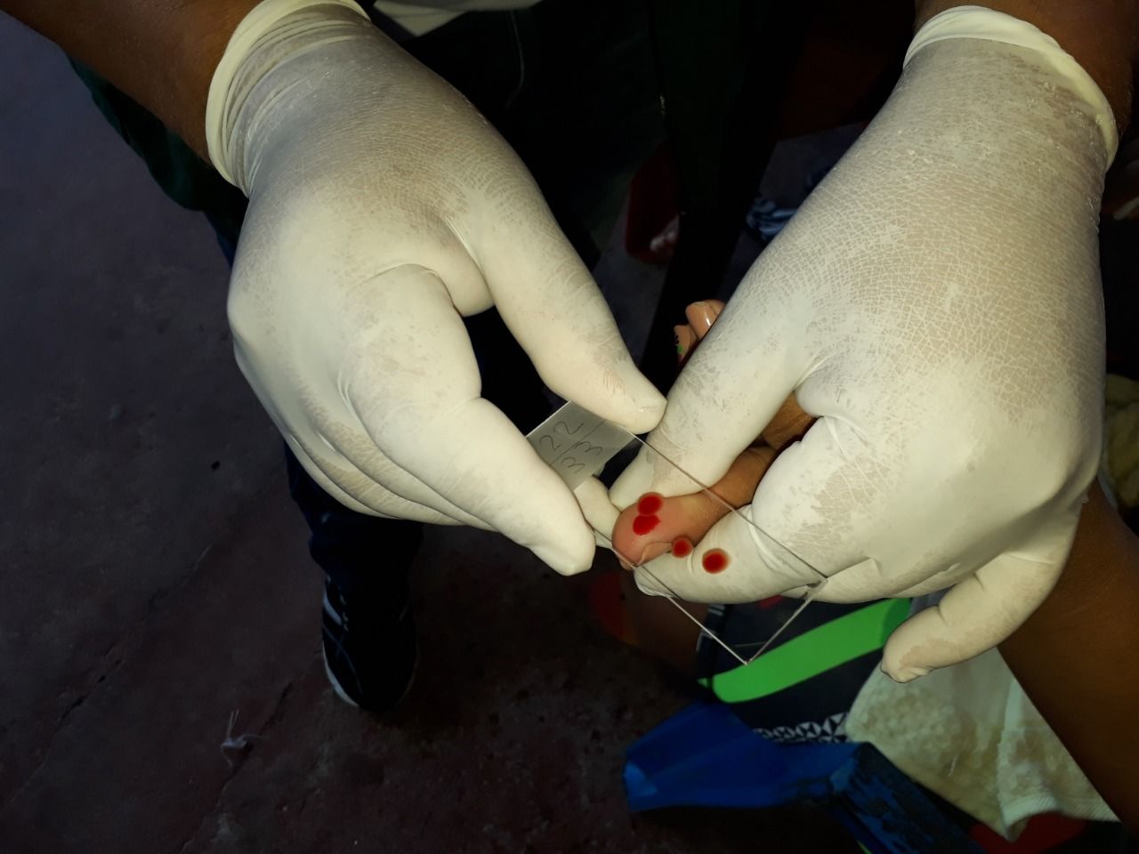 Manaus encerrou 2022 com o menor número de casos de malária dos últimos quatro anos