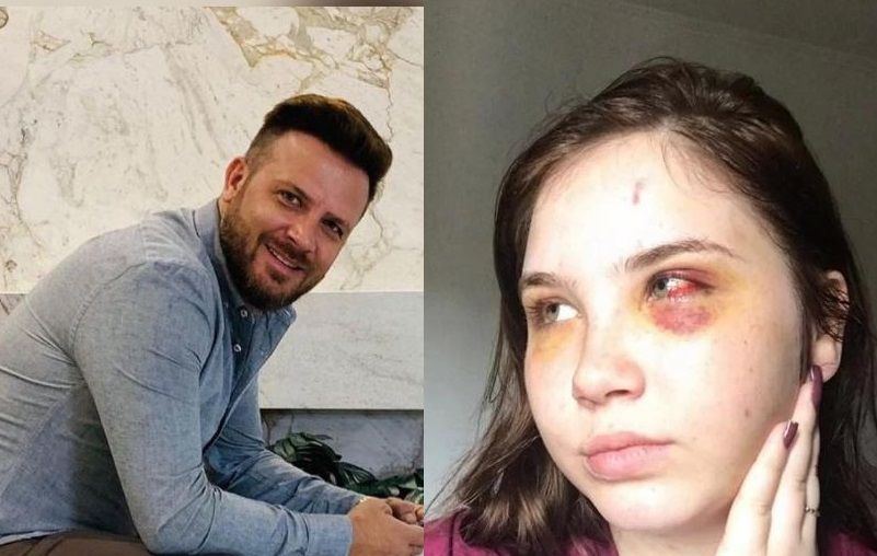 Sertanejo é acusado pela filha de tentativa de homicídio: ‘achei que ia morrer’