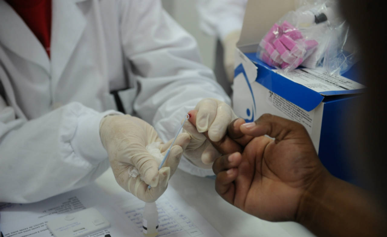 Amazonas apresenta queda em casos de óbitos por aids