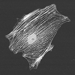 PMC exhibits less sensitivity to decreasing signal-to-noise ratio (SNR)