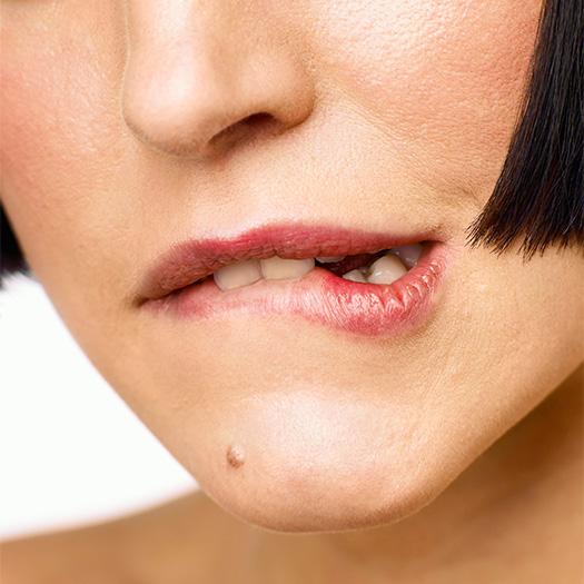 mole in chin