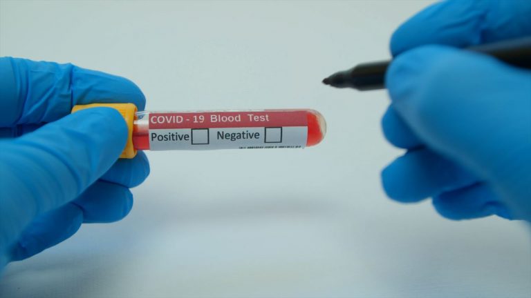 Studies of St. Louis COVID19 Patients Follow ‘Long