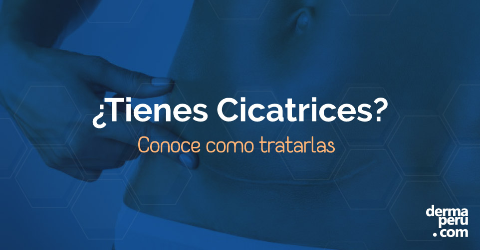 Cicatriz blanca, todo lo que debes saber