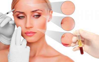 tratamiento-plasma-rico-en-plaquetas-lima-peru-dermaperu tratamiento-plasma-rico-en-plaquetas-lima-peru-dermaperu